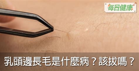 女生乳頭長毛|乳頭邊長了毛，是什麼病？該不該拔？讓名醫一次解釋給您聽｜每